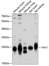 Anti-CD90 antibody used in Western Blot (WB). GTX32508
