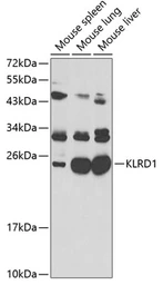 Anti-CD94 antibody used in Western Blot (WB). GTX32509