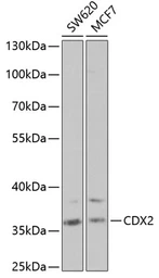 Anti-CDX2 antibody used in Western Blot (WB). GTX32513