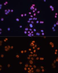 Anti-CDX2 antibody used in Immunocytochemistry/ Immunofluorescence (ICC/IF). GTX32513