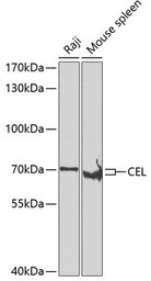 Anti-CEL antibody used in Western Blot (WB). GTX32515