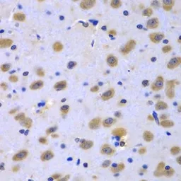 Anti-CIAO1 antibody used in IHC (Paraffin sections) (IHC-P). GTX32522