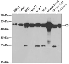 Anti-Citrate synthase antibody used in Western Blot (WB). GTX32524