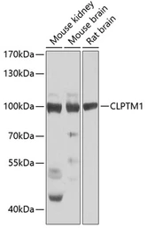Anti-CLPTM1 antibody used in Western Blot (WB). GTX32528