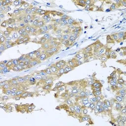 Anti-COQ7 antibody used in IHC (Paraffin sections) (IHC-P). GTX32534