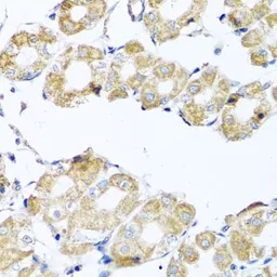 Anti-COQ7 antibody used in IHC (Paraffin sections) (IHC-P). GTX32534