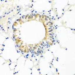 Anti-COQ7 antibody used in IHC (Paraffin sections) (IHC-P). GTX32534