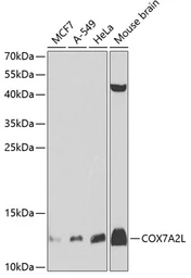Anti-COX7A2L antibody used in Western Blot (WB). GTX32535