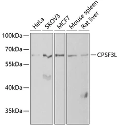 Anti-CPSF3L antibody used in Western Blot (WB). GTX32537