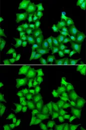 Anti-CPSF3L antibody used in Immunocytochemistry/ Immunofluorescence (ICC/IF). GTX32537