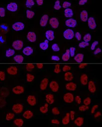 Anti-CTCF antibody used in Immunocytochemistry/ Immunofluorescence (ICC/IF). GTX32541