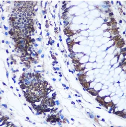 Anti-CTCF antibody used in IHC (Paraffin sections) (IHC-P). GTX32541