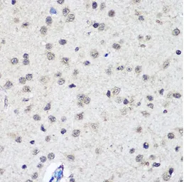 Anti-CTCF antibody used in IHC (Paraffin sections) (IHC-P). GTX32541