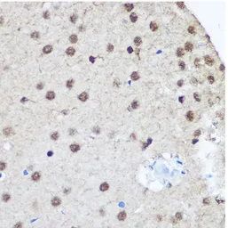 Anti-CTCF antibody used in IHC (Paraffin sections) (IHC-P). GTX32541