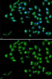Anti-CTNNBL1 antibody used in Immunocytochemistry/ Immunofluorescence (ICC/IF). GTX32543