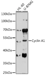 Anti-Cyclin A1 antibody used in Western Blot (WB). GTX32544