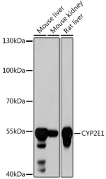 Anti-CYP2E1 antibody used in Western Blot (WB). GTX32546