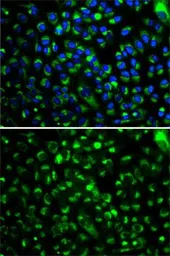 Anti-CYP2E1 antibody used in Immunocytochemistry/ Immunofluorescence (ICC/IF). GTX32546