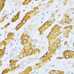 Anti-CYP2E1 antibody used in IHC (Paraffin sections) (IHC-P). GTX32546