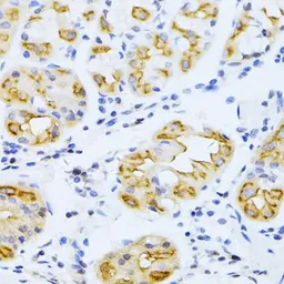 Anti-CYP2E1 antibody used in IHC (Paraffin sections) (IHC-P). GTX32546