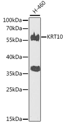 Anti-Cytokeratin 10 antibody used in Western Blot (WB). GTX32547