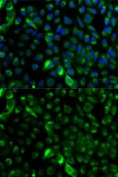 Anti-Cytokeratin 17 antibody used in Immunocytochemistry/ Immunofluorescence (ICC/IF). GTX32548