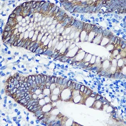 Anti-Cytokeratin 8 antibody used in IHC (Paraffin sections) (IHC-P). GTX32549