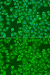 Anti-DCP2 antibody used in Immunocytochemistry/ Immunofluorescence (ICC/IF). GTX32554