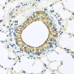 Anti-DCP2 antibody used in IHC (Paraffin sections) (IHC-P). GTX32554