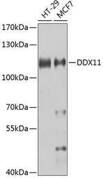 Anti-DDX11 antibody used in Western Blot (WB). GTX32556