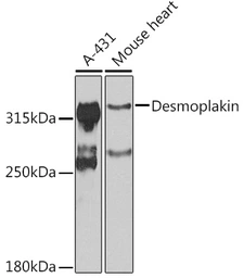 Anti-Desmoplakin antibody used in Western Blot (WB). GTX32557