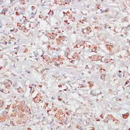 Anti-Desmoplakin antibody used in IHC (Paraffin sections) (IHC-P). GTX32557