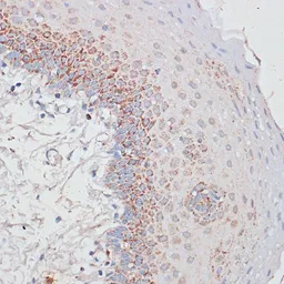 Anti-Desmoplakin antibody used in IHC (Paraffin sections) (IHC-P). GTX32557