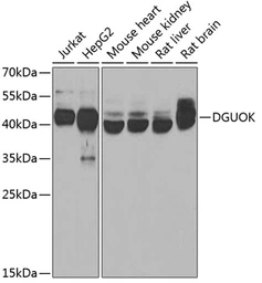 Anti-DGUOK antibody used in Western Blot (WB). GTX32559