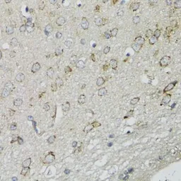 Anti-DGUOK antibody used in IHC (Paraffin sections) (IHC-P). GTX32559
