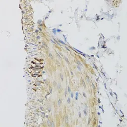 Anti-DGUOK antibody used in IHC (Paraffin sections) (IHC-P). GTX32559