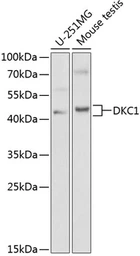 Anti-DKC1 antibody used in Western Blot (WB). GTX32562