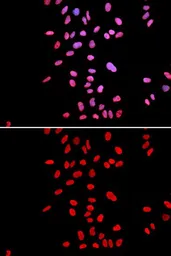Anti-DKC1 antibody used in Immunocytochemistry/ Immunofluorescence (ICC/IF). GTX32562