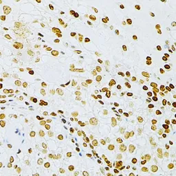 Anti-DKC1 antibody used in IHC (Paraffin sections) (IHC-P). GTX32562