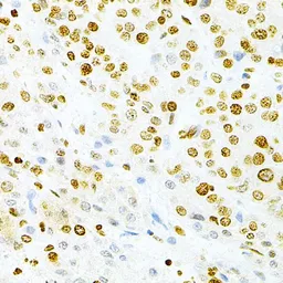 Anti-DKC1 antibody used in IHC (Paraffin sections) (IHC-P). GTX32562