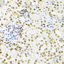 Anti-DKC1 antibody used in IHC (Paraffin sections) (IHC-P). GTX32562