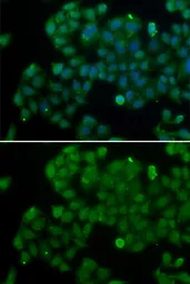 Anti-DNMT3L antibody used in Immunocytochemistry/ Immunofluorescence (ICC/IF). GTX32565