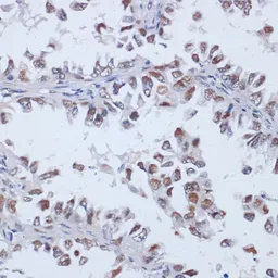 Anti-DNMT3L antibody used in IHC (Paraffin sections) (IHC-P). GTX32565