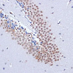 Anti-DNMT3L antibody used in IHC (Paraffin sections) (IHC-P). GTX32565