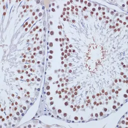 Anti-DNMT3L antibody used in IHC (Paraffin sections) (IHC-P). GTX32565