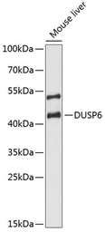 Anti-DUSP6 antibody used in Western Blot (WB). GTX32567