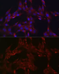 Anti-DUSP6 antibody used in Immunocytochemistry/ Immunofluorescence (ICC/IF). GTX32567