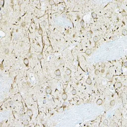 Anti-DUSP6 antibody used in IHC (Paraffin sections) (IHC-P). GTX32567