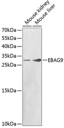 Anti-EBAG9 antibody used in Western Blot (WB). GTX32570
