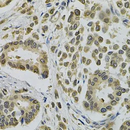 Anti-EBAG9 antibody used in IHC (Paraffin sections) (IHC-P). GTX32570